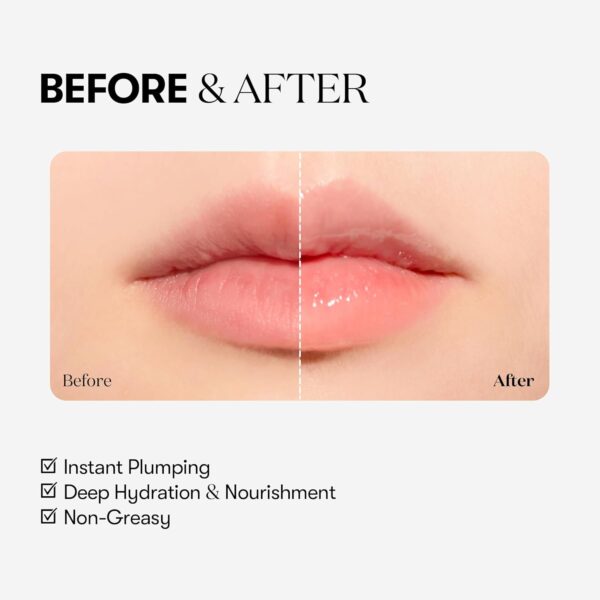 VTCOSMETICS Reedle Shot Lip Plumper, 0.15 oz (4.3 g), Moisturizing, Transparent, Lip Gloss, Fragrance-free, Korean Cosmetics (Beginner) - Image 5