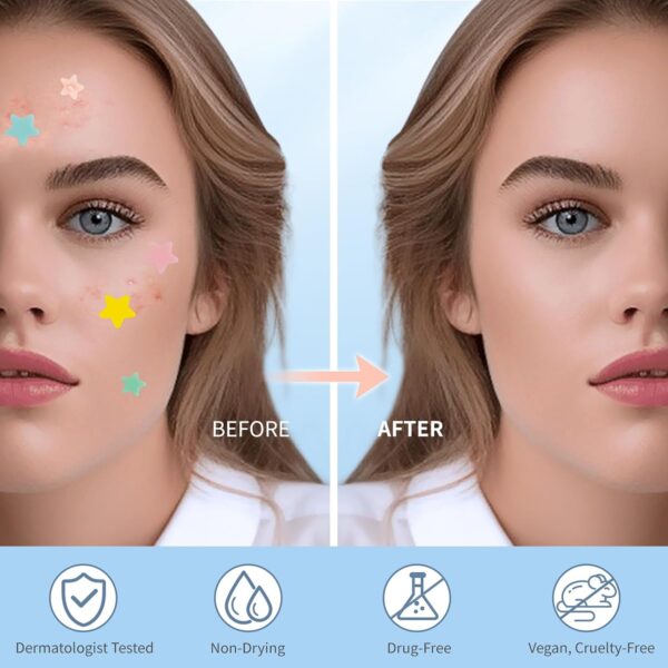 Pimple Patches for Face, Hydrocolloid Acne Patches, Cute Star Zit Covers, Colorful Spot Stickers with Tea Tree, Salicylic Acid & Cica Oil| 3 Sizes (10mm, 12mm & 14mm) |200 Count - Image 5