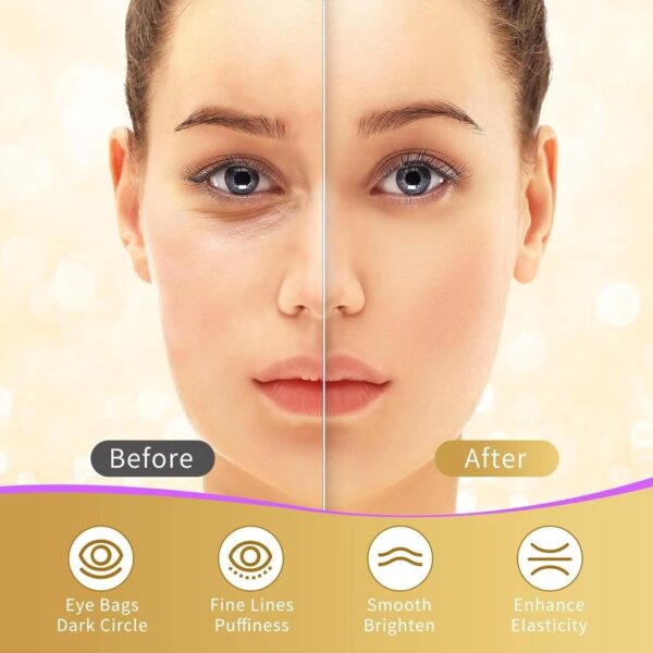 Under Eye Patches, 40 Pairs Eye Mask for Dark Circles, Puffy Eyes, Undereye Bags,Wrinkles,Eye Mask Patches with 24K Gold, Hyaluronic Acid,Rose & Aloe Vera, Eye Treatment Skin Care for Men & Women Gift - Image 5
