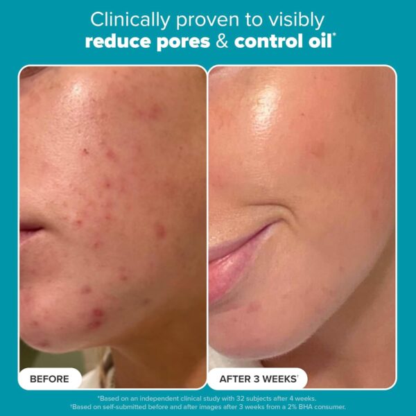 Paula's Choice SKIN PERFECTING 2% BHA Liquid Salicylic Acid Exfoliant-Facial Exfoliant for Enlarged Pores, Wrinkles & Fine Lines and Suitable for Blackhead-Prone Skin - Image 6