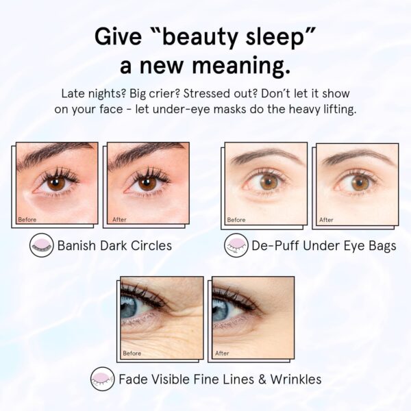grace & stella Under Eye Patches for Puffy Eyes and Dark Circles (Retinol, 24 Pairs) Restoring Gel Under Eye Masks with Hyaluronic Acid - Vegan Cruelty-Free Skincare Birthday Gifts for Women - Image 5