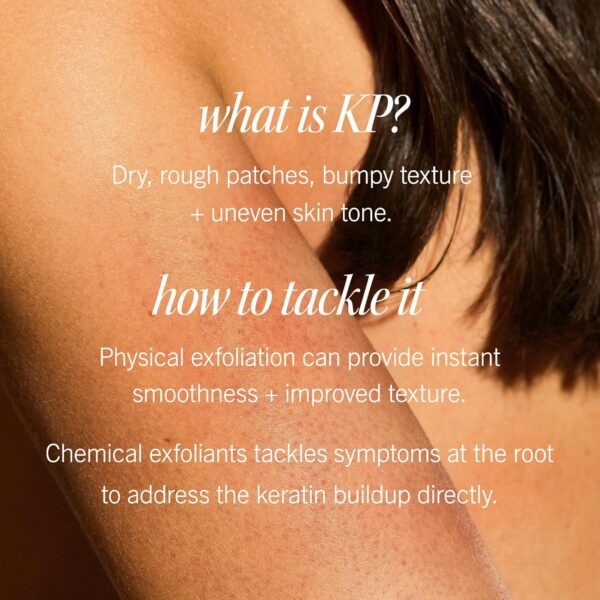 First Aid Beauty - KP Bump Eraser Body Scrub with 10% AHA, Keratosis Pilaris Skin Exfoliator with Glycolic and Lactic acids, Helps Reduce Chicken Skin Bumps, Safe for Sensitive Skin, 8 oz - Image 5