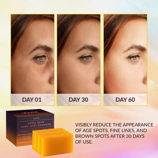 VALITIC Kojic Acid Dark Spot Remover Soap Bars with Vitamin C, Retinol, Collagen, Turmeric - Original Japanese Complex Infused with Hyaluronic Acid, Vitamin E, Shea Butter, Castile Olive Oil (3 Pack) - Image 3