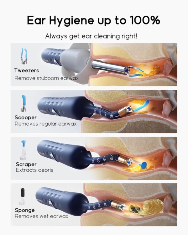 Bebird Earsight Plus D39R Ear Wax Removal Tool Camera, FSA HSA Eligible Items, Ear Cleaner with Flexible Ear Camera Otoscope, Visual Ear Pick Tweezers Wax Remover, Ear Cleaning Kit for Family - Image 6